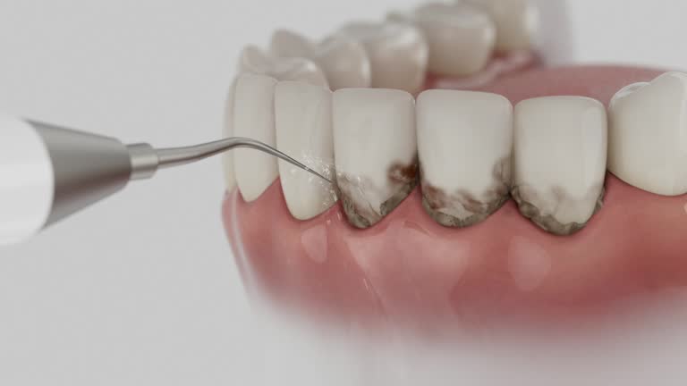 Reliable Tooth Extraction contractor in Terrell County County, GA by Dentist Open Now